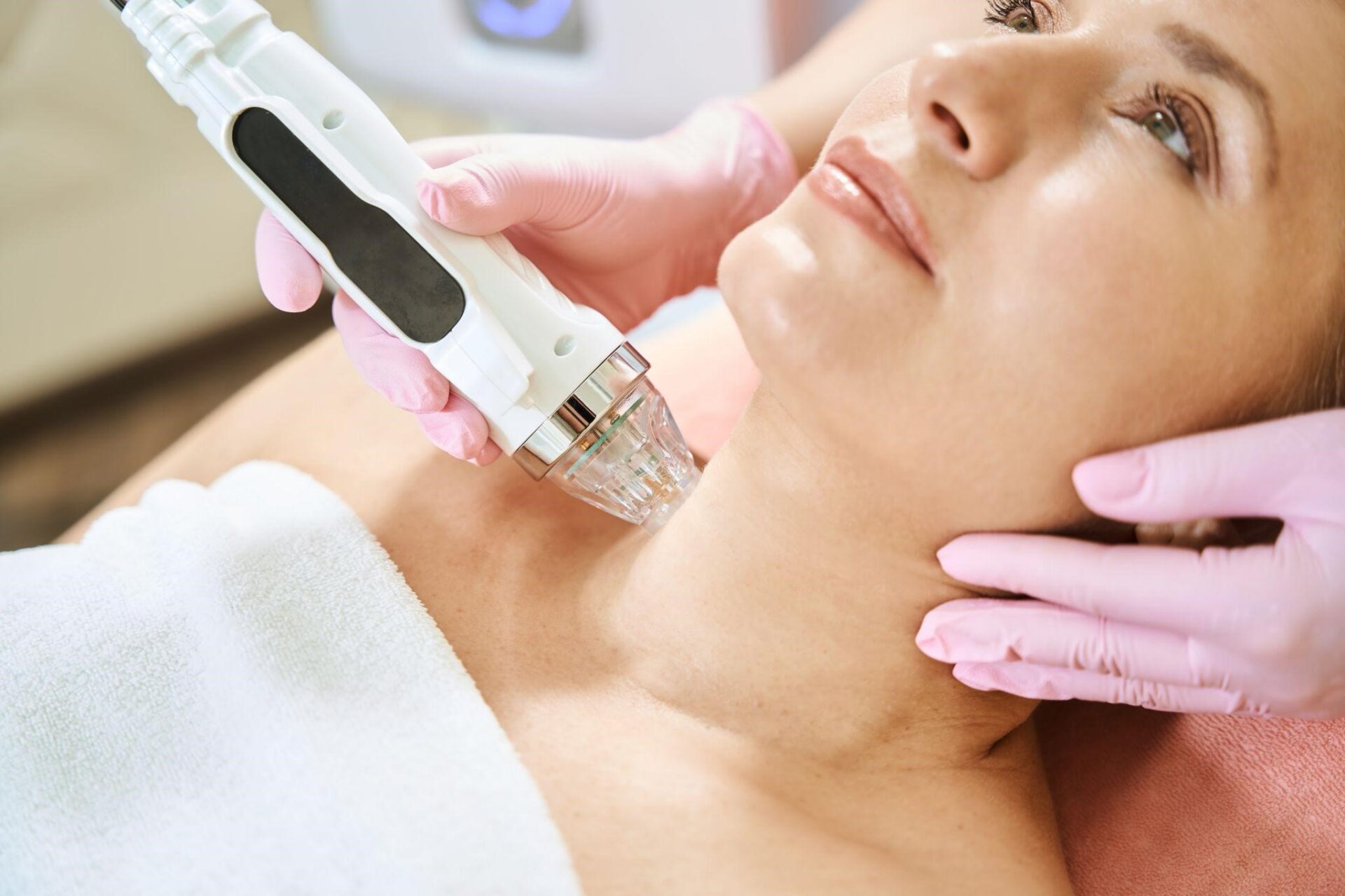 RF Microneedling Procedure at Manhattan Laser Spa